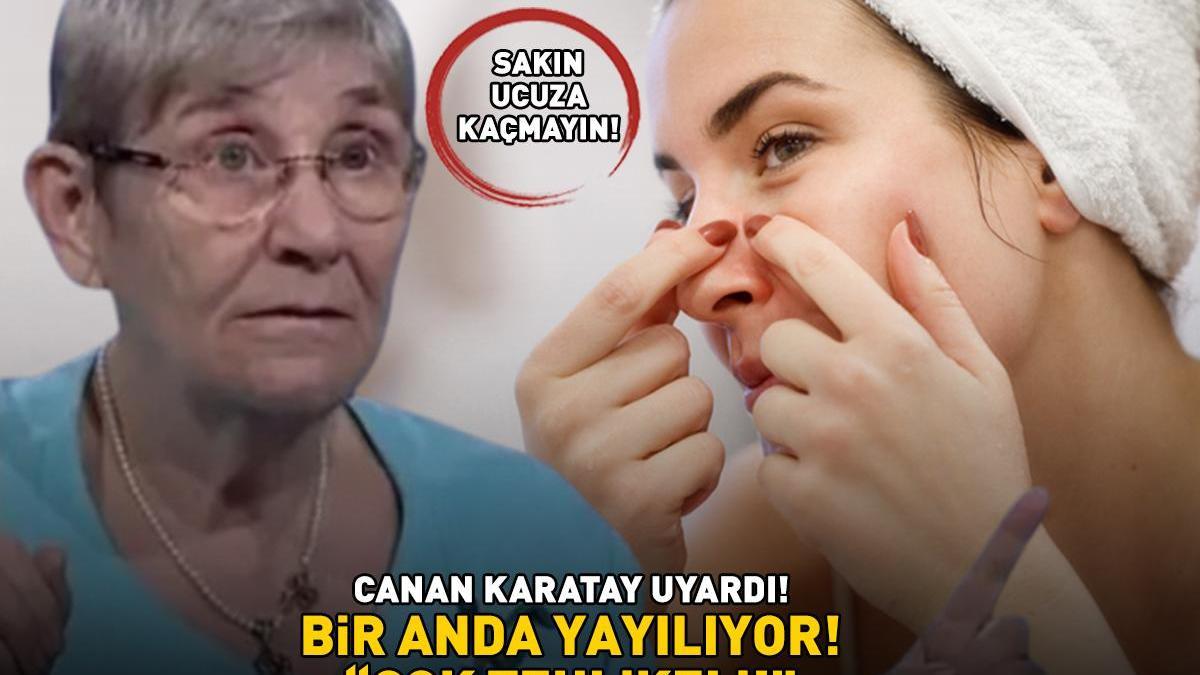 ‘ÇOK TEHLİKELİ!’ Akne ve sivilceler bir anda cilde yayılıyor! Prof. Dr. Canan Karatay uyardı: ‘Ucuza kaçıp en kötüsünü almayın!’